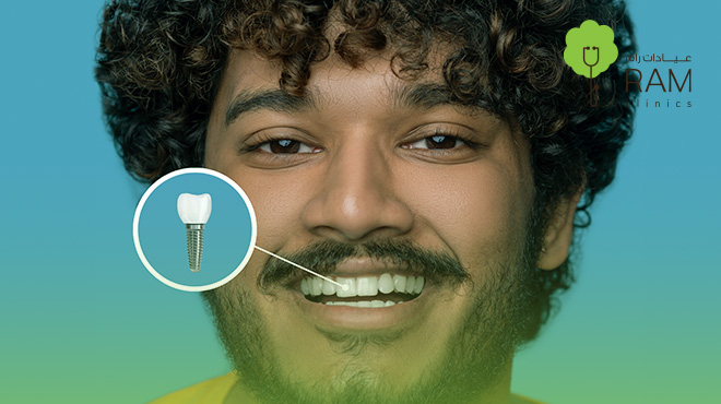 أسعار-زراعة-الأسنان-في-البحرين