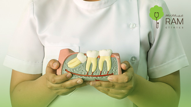 اشكال-ضرس-العقل-المدفون