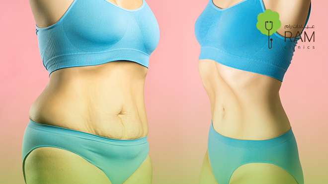 متى-تظهر-نتيجة-نحت-الجسم