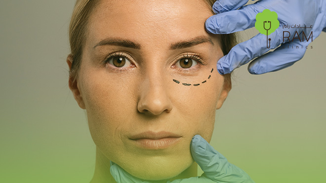 جلسة-رتوش-بعد-الفيلر