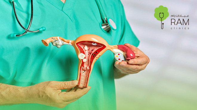 بطانة-الرحم-المهاجرة