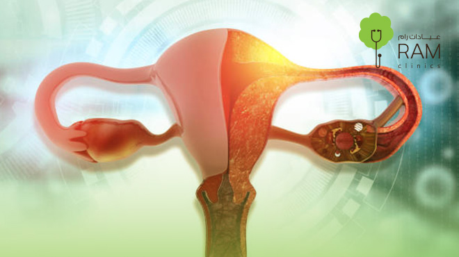 أنواع-بطانة-الرحم-المهاجرة