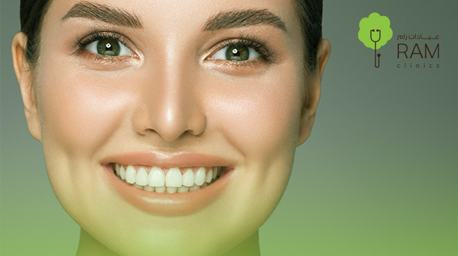 عروض-على-ابتسامة-هوليود