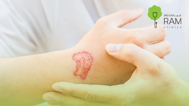 هل-عملية-ترقيع-الجلد-خطيرة