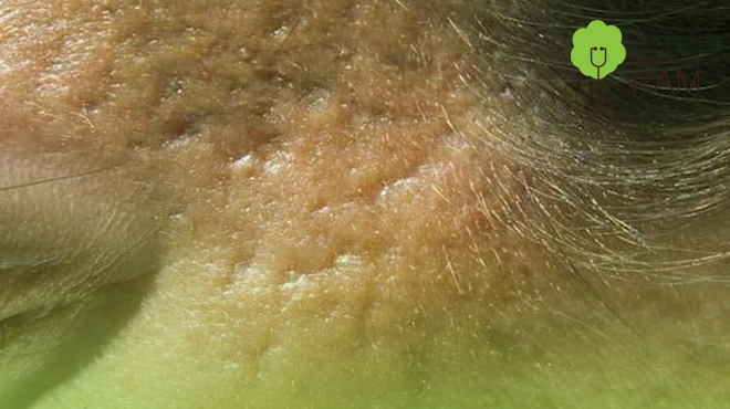 جلسة-تقطيع-الألياف