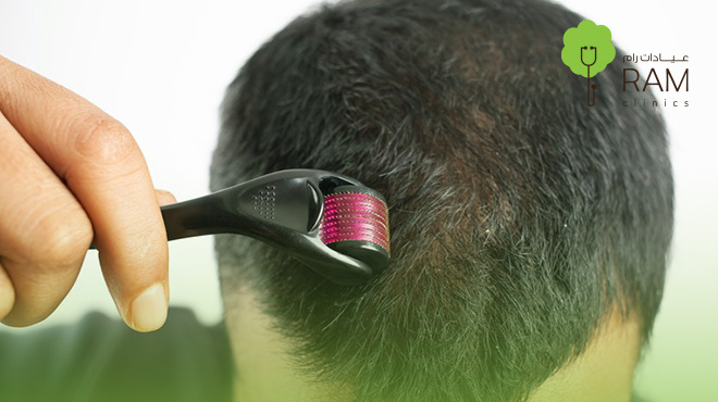 فوائد-ديرما-بن-للشعر 