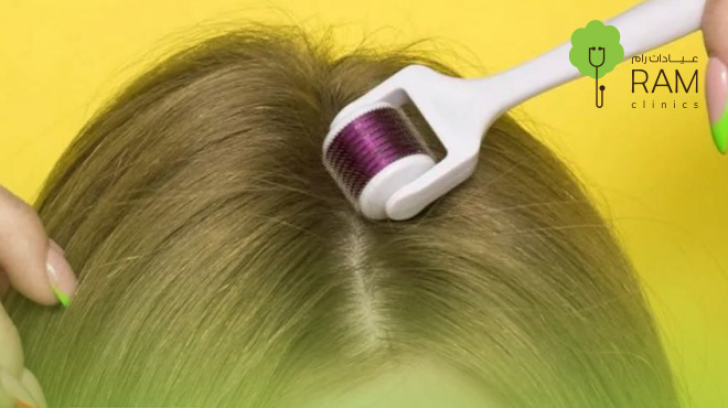 فوائد-ديرما-بن-للشعر 