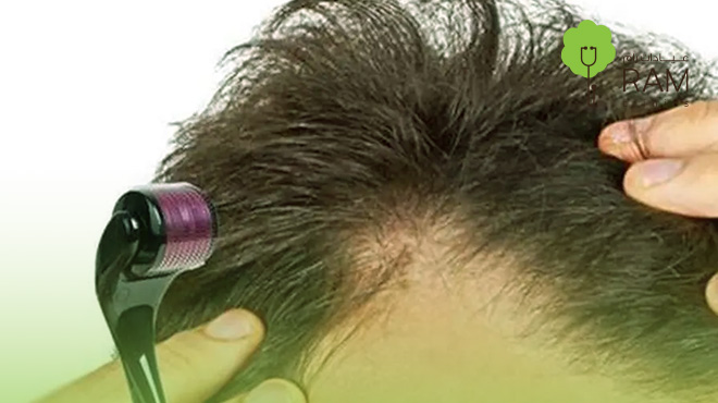 فوائد-ديرما-بن-للشعر 