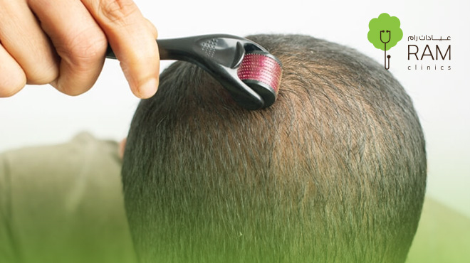 فوائد-ديرما-بن-للشعر 