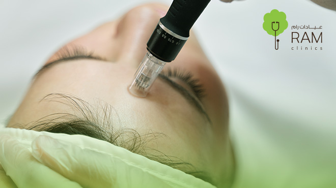 ديرما-بن-للوجه