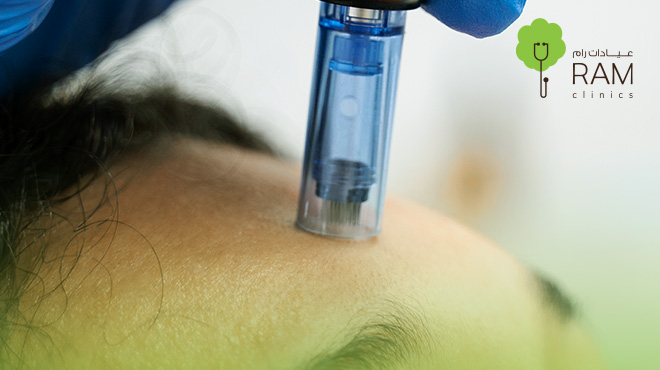 ديرما-بن-للوجه