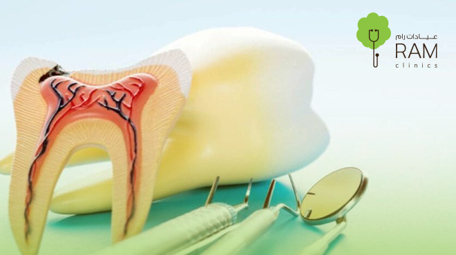 أفضل-دكتور-عصب-أسنان-في-البحرين