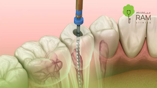 أفضل-دكتور-عصب-أسنان-في-البحرين